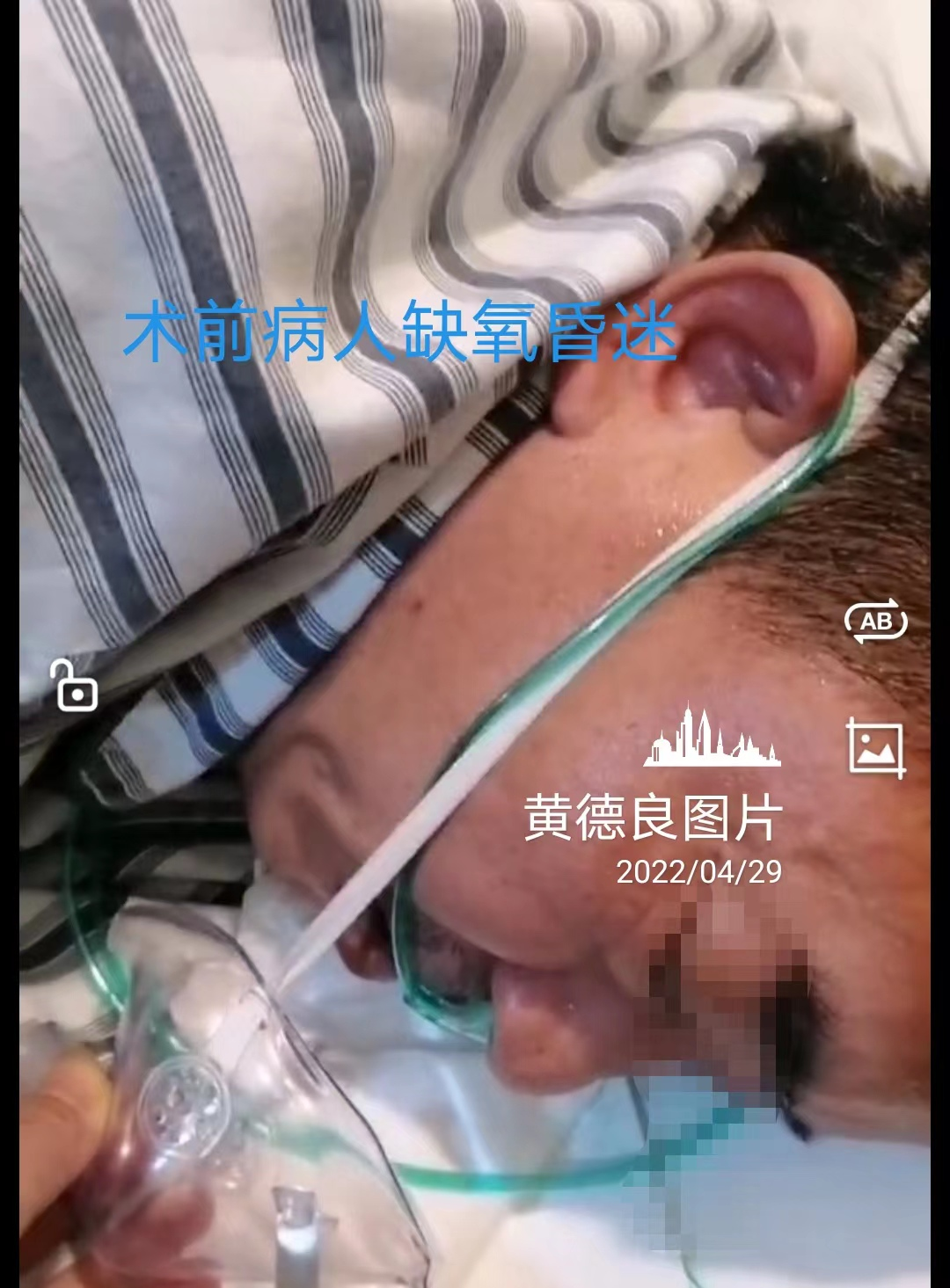 Patient in coma before surgery