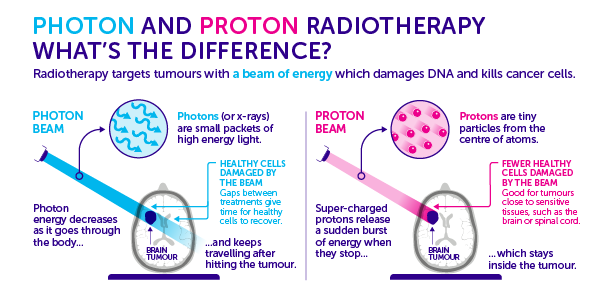 Proton Treatment